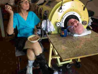 Akhir Perjuangan Paul Alexander Menghadapi Dampak Polio